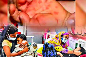 fiebre-del-tomate-en-india-que-es-que-sintomas-tiene-como-se-transmite-y-a-quien-afecta
