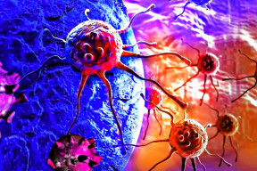 la-incidencia-del-cancer-aumentara-un-75-en-2030-segun-los-cientificos